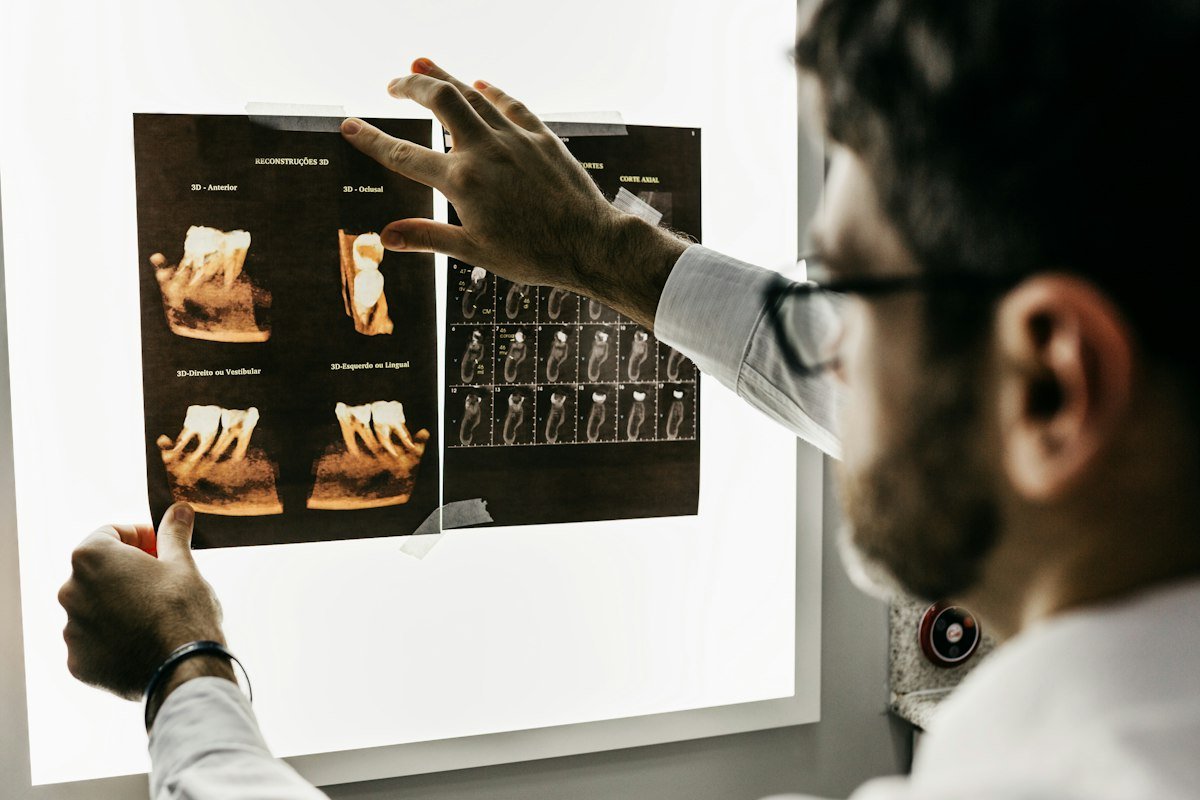 Dental Tourism in Turkey Guide: Veneers, Implants & Costs